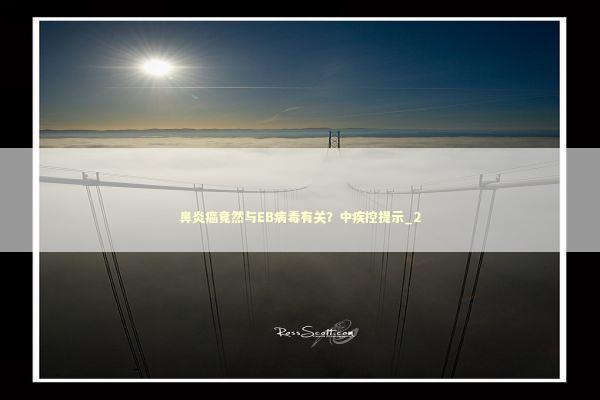 鼻炎癌竟然与EB病毒有关？中疾控提示_2